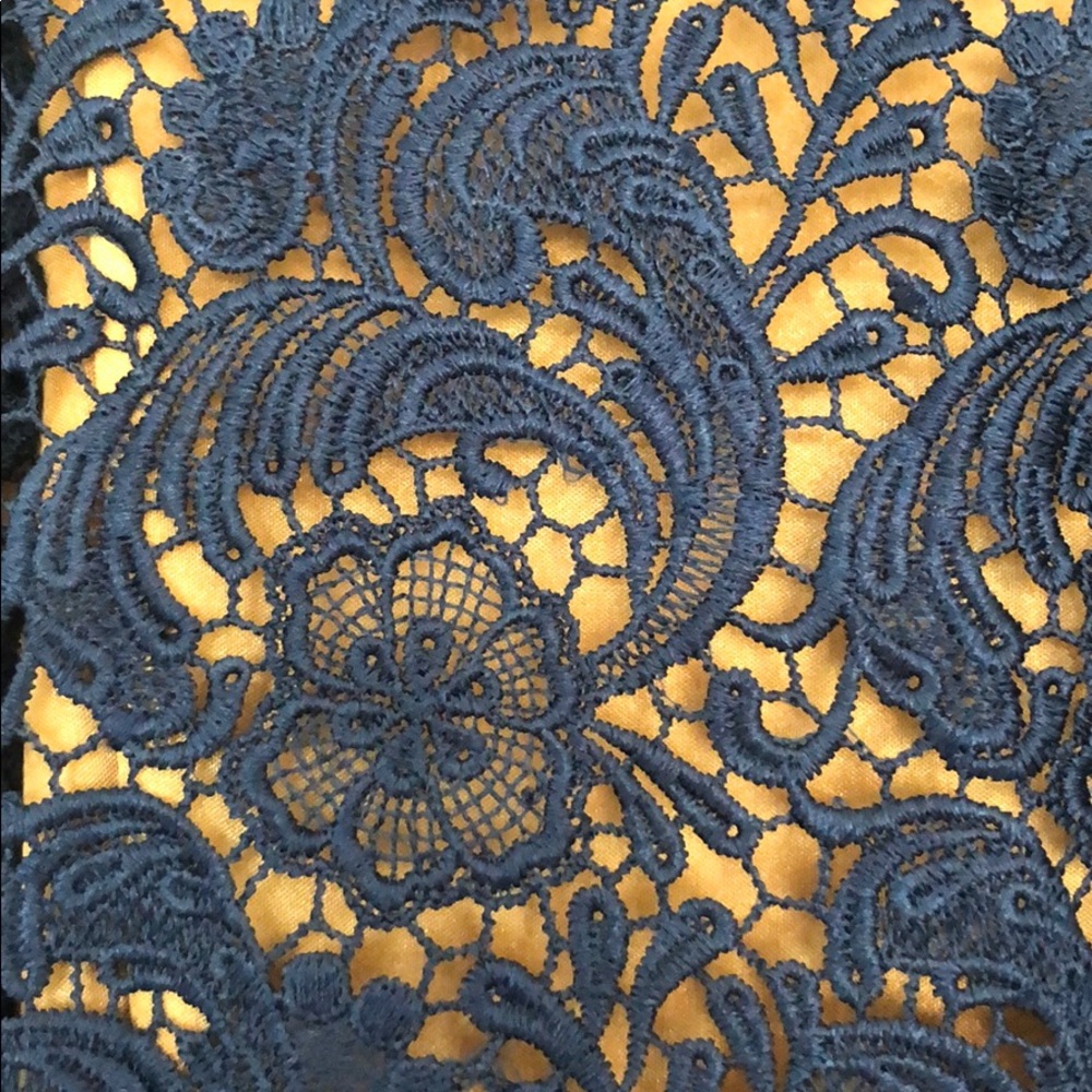 LACE DRESS 💙 - Picture 3 of 6